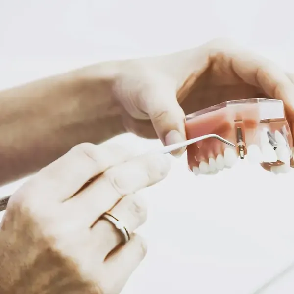 Mãos seguram um modelo de prótese dentária